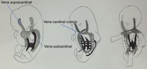 Se muestra la vena cardinal izquierda involucionando y la vena cardinal derecha formando la vena cava superior.