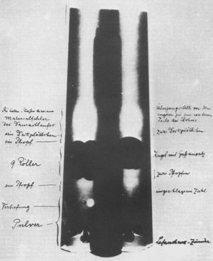 Radiografía de la escopeta de Röntgen2.