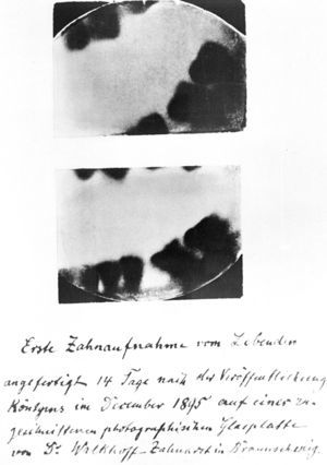 Primeras radiografías dentales.