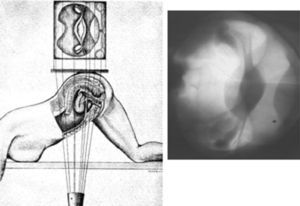 Esquema de dirección del haz de rayos X y su correspondencia radiológica.