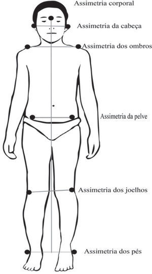 Marcações anatômicas em plano frontal