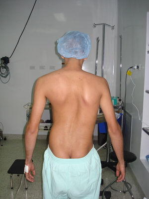 Imagen del paciente antes de la primera cirugía.