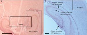 Microfotografías de histología de zonas encefálicas evaluadas en un cerebro de rata neonatal expuesto a sevoflurano. Se muestran las distintas áreas estudiadas. 2A) Tálamo e hipocampo, corte transversal. Barra escala 1mm. 2B) Corteza prefrontal y estratos del hipocampo, corte coronal. Barra escala 100μm. Las secciones se tiñeron para inmunoquímicamente revelar la activación de caspasa-3.