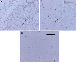 Inmunoperoxidasa para caspasa-3 en tálamo. A) Rata del grupo sevoflurano1; obsérvese la marcación positiva moderada en las neuronas del tálamo (flechas). B) Rata del grupo sevoflurano2; obsérvese la marcación positiva leve en las neuronas del tálamo (flecha). C) Rata del grupo comportamiento-sevoflurano; obsérvese la ausencia de marcación en las neuronas. Barra escala 50μm.