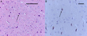 Corte de corteza de rata del grupo comportamiento-oxígeno. A) Se observan focos pequeños de muerte neuronal (flecha) (H-E). Barra escala 50μm. B) Inmunohistoquímica para anti-caspasa-3; obsérvese las neuronas necróticas y la marcación positiva leve para el marcador (flecha). Barra escala 20μm (H-E).