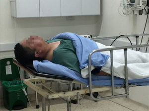 Paciente en postoperatorio de vasectomía con anestesia general. Clínica Profamilia Bogotá. Fuente: autores.