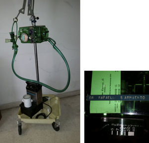 Respirador Bird Mark 7 y el nebulizador ultrasónico usado para la atención del Dr. Villegas. En la parte superior, la marca de su propietario, el Dr. Sarmiento.