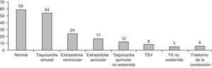Diagnósticos electrocardiográficos del MEE.