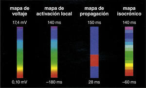 Escala de colores usada con diferentes propósitos para recrear un mapa tridimensional. Si se usa para correlacionar el voltaje de un punto específico el color rojo será el más bajo voltaje y el gris indicará ausencia de voltaje (mapa de voltaje, de izquierda a derecha); si se usa para indicar que un punto es precoz, el color rojo indicará la máxima precocidad en relación con una señal de referencia (mapa de activación local). El mapa de propagación utilizará la secuencia dinámica de puntos precoces a tardíos haciendo correr un ciclo cardiaco completo, lo que dará la imagen de propagación de un impulso (mapa de propagación). El mapa isocrónico es una forma de mapa de activación local segmentado por intervalos de tiempo. Tomado con permiso de Vanegas1.