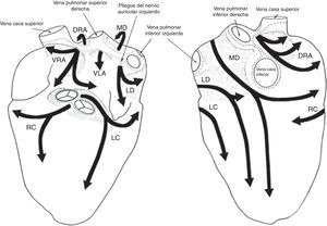 Esquema que resume la descripción de la disposición y las regiones de inervación de los siete subplexos epicárdicos en humanos. Izquierda: Vista ventral. Derecha: Vista dorsal. Los subplexos ganglionares se representan mediante sombras. Las líneas de puntos indican los límites del hilio corazón. VRA: subplexos ganglionares de la aurícula derecha; DRA: subplexos dorsales de la aurícula derecha; MD: subplexo ganglionar dorsal medio; VLA: subplexo ganglionar de la aurícula izquierda; LD: subplexo ganglionar dorsal izquierdo; RC: subplexo ganglionar coronario derecho; LC=subplexo ganglionar coronario izquierdo7.
