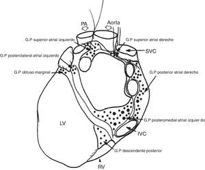 Localización de los plexos ganglionares8. GP: plexo ganglionar, PA: arteria pulmonar, SVC: vena cava superior, IVC: vena cava inferior, RV: ventrículo derecho, LV: ventrículo izquierdo.