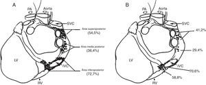 A, distribución de sitios donde la aplicación de radiofrecuencia evocaba una respuesta parasimpática durante la ablación anatómica. B, distribución de sitios donde la estimulación de alta frecuencia evocaba una respuesta parasimpática durante el enfoque selectivo. PA, arteria pulmonar; IVC: vena cava inferior; SVC: vena cava superior; RV: ventrículo derecho; y LV: ventrículo izquierdo22.