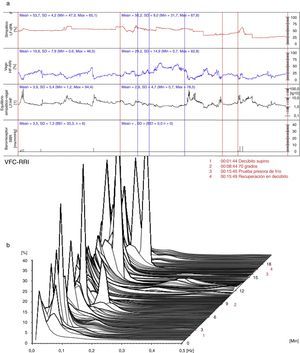 (a) (arriba) Evaluación hemodinámica y autonómica (06/11/2012): predominio simpático, desequilibrio simpático-vagal y disminución de la actividad barorrefleja. LF-dPA: componente de baja frecuencia del análisis espectral de la variabilidad de la presión arterial. HF-RRI: componente de alta frecuencia del análisis espectral de la variabilidad de la frecuencia cardiaca. SBR: sensibilidad del reflejo barorreceptor. (b) (abajo) Análisis espectral de la variabilidad de la frecuencia cardiaca (06/11/2012): predominio del componente simpático. VFC-RRI: variabilidad de la frecuencia cardiaca (intervalo R-R).