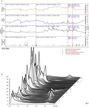 (a) (arriba) Evaluación hemodinámica y autonómica (15/11/2012): predominio simpático, mayor equilibrio simpático-vagal y recuperación de la actividad barorrefleja. LF-dPA: componente de baja frecuencia del análisis espectral de la variabilidad de la presión arterial. HF-RRI: Componente de alta frecuencia del análisis espectral de la variabilidad de la frecuencia cardiaca. SBR: sensibilidad del reflejo barorreceptor. (b) (abajo) Análisis espectral de la variabilidad de la frecuencia cardiaca (15/11/2012): atenuación del componente simpático en reposo. VFC-RRI: variabilidad de la frecuencia cardiaca (intervalo R-R).