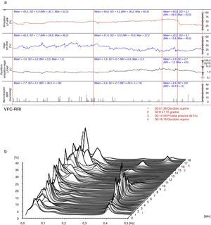 (a) (arriba) Evaluación hemodinámica y autonómica (06/10/2015): predominio vagal en reposo, equilibrio simpático-vagal y actividad barorrefleja adecuada. LF-dPA: componente de baja frecuencia del análisis espectral de la variabilidad de la presión arterial. HF-RRI: componente de alta frecuencia del análisis espectral de la variabilidad de la frecuencia cardiaca. SBR: sensibilidad del reflejo barorreceptor. (b) (abajo) Análisis espectral de la variabilidad de la frecuencia cardiaca (06/10/2015): equilibrio simpático-vagal. VFC-RRI: variabilidad de la frecuencia cardiaca (intervalo R-R).