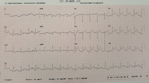 Electrocardiograma inicial.