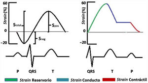Nomenclatura del strain auricular con base en el punto de referencia cero.
