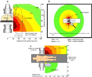 a) Distribución de dosis de exposición con la geometría del tubo de rayos X bajo la mesa; la intensidad es mucho mayor en los miembros inferiores del médico intervencionista3. b) La distribución de la exposición varía con la distancia4. c) Distribución de la exposición en proyecciones laterales4.