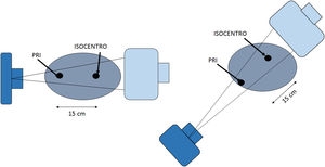 Geometría del punto de referencia intervencionista (PRI) y el isocentro.