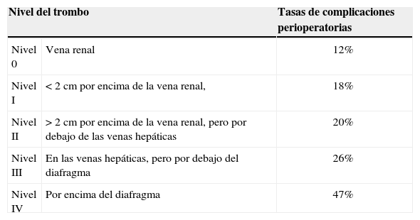 Tablas