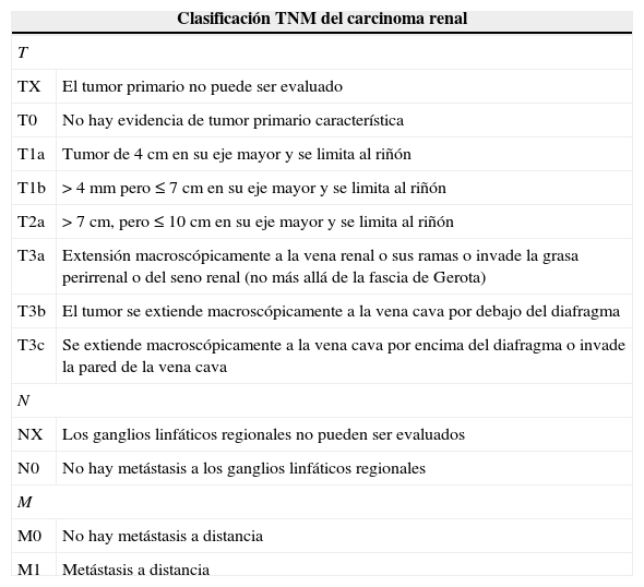 Tablas