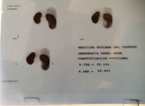 DMSA.
