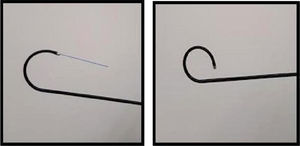Loss of deflection of the flexible ureteroscope with laser fiber in its channel close to 40°.