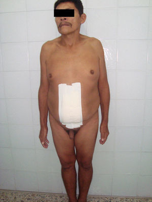 Paciente fenotípicamente masculino.