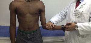 Prueba de sulcus.