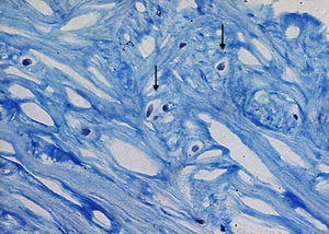 Corte histológico de cartílago articular con tinción de Gomory caracterizado por condrocitos poliédricos grandes y claros (↓), rodeados por fibras de colágena gruesas (200X).