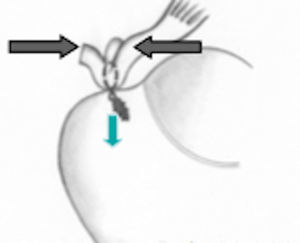 Esquema de fila única.