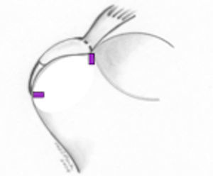 Restitución de la huella; doble fila.
