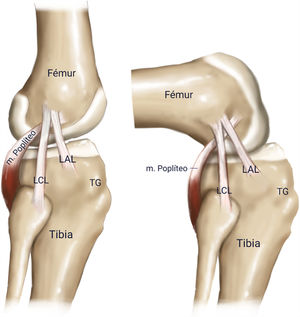 Imagen lateral en extensión y flexión del ligamento anterolateral según la descripción de Claes y los estudios iniciales, con el origen femoral anterior y distal al ligamento colateral externo.
