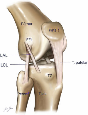 Imagen oblicua del ligamento anterolateral según la descripción de Dodds y los estudios más recientes.
