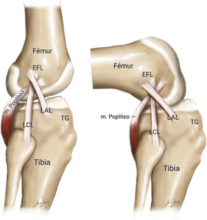 Imagen lateral en extensión y flexión del ligamento anterolateral según la descripción de Dodds y los estudios más recientes, con el origen femoral posterior y proximal al ligamento colateral externo.