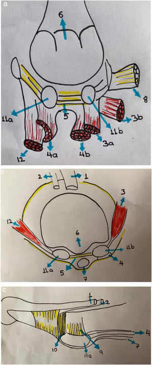 (a,b,c): 1. Tendón extensor hallucis longus 2. Tendón extensor hallucis Brevis 3. Tendón aductor del hallux 3a. Porción oblicua 3b. Porción transversa 4.Tendon flexor hallucis brevis 4a. Lateral 4b. Medial 5. Ligamento intermetatarsiano 6. Cresta 7. Tendon flexor hallucis longus 8. Ligamento transverso profundo metatarsiano 9. Ligamento sesamoideo 10. Ligamento colateral 11a. Sesamoideo medial 11b. Sesamoideo lateral 12. Abductor del hallux.
