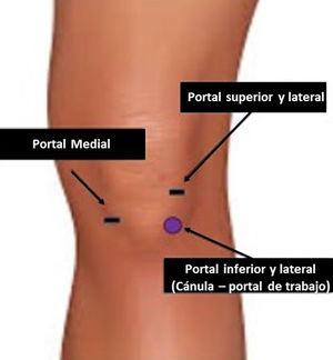 Esquema de posición de portales.