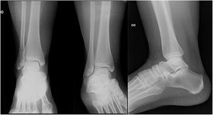 Radiografia Comparativa normal caso 1.