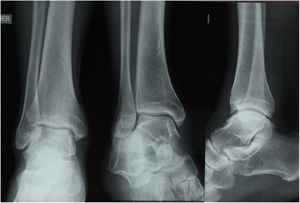 Comparative normal Radiography case 2.