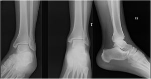 Comparative normal Radiography case 3.