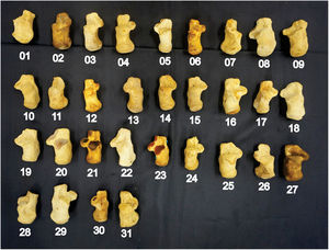 Fotografía de los 31 calcáneos (piezas óseas) que conforman nuestra muestra.