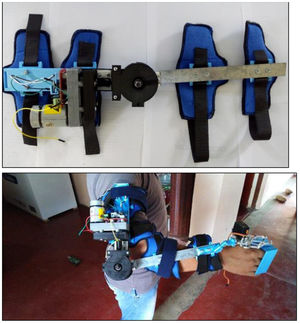 Prototipo de órtesis activa.