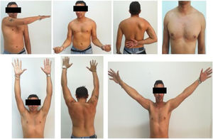 Evolución del paciente a los 6 meses.