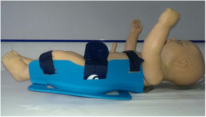 Vista lateral del dispositivo anti rotatorio adaptado. Fuente Imágenes propias.