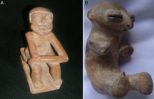 A: cerámica del altiplano nariñense colombiano de la cultura Capulí, con amputación del antebrazo derecho. B: cerámica de la cultura Sinú, sin manos ni antebrazos.