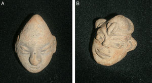 Cultura Tumaco-La Tolita con deformación del cráneo de forma cónica, parecido a las pirámides.