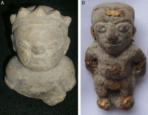 Dos enanos de la cultura Tumaco-La Tolita. A: corresponde a una acondroplasia. B: con 9 placas de oro en diferentes partes del cuerpo.