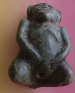 Mujer con las piernas dobladas y recogidas, con las manos en el bajo vientre, mostrando el ano dilatado.