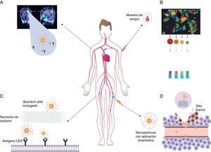 Aplicación de nanopartículas multifuncionales en el diagnóstico, tratamiento y teranóstica de enfermedades autoinmunes. A) El medio de contraste con nanopartículas se usa para el diagnóstico in vivo en procedimientos de tomografías y resonancias magnéticas nucleares. B) Bioconjugados de nanopartículas heterofuncionalizadas cubiertas con anticuerpos, aptámeros, péptidos y moléculas pequeñas, usados para el marcaje de tejidos sano y anormal en pruebas diagnósticas in vitro. C) Los quantums dots pueden ser usados para marcar fármacos o nanotransportadores. D) Las nanopartículas pueden emplearse como agentes teranósticos con alta especificidad molecular. Fuente: tomado de Autoimmunity. From bench to bedside, previa autorización del autor Dr. Juan Manuel Anaya.