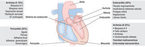 Frecuencia y tipo de compromiso cardiaco en el lupus eritematoso sistémico.